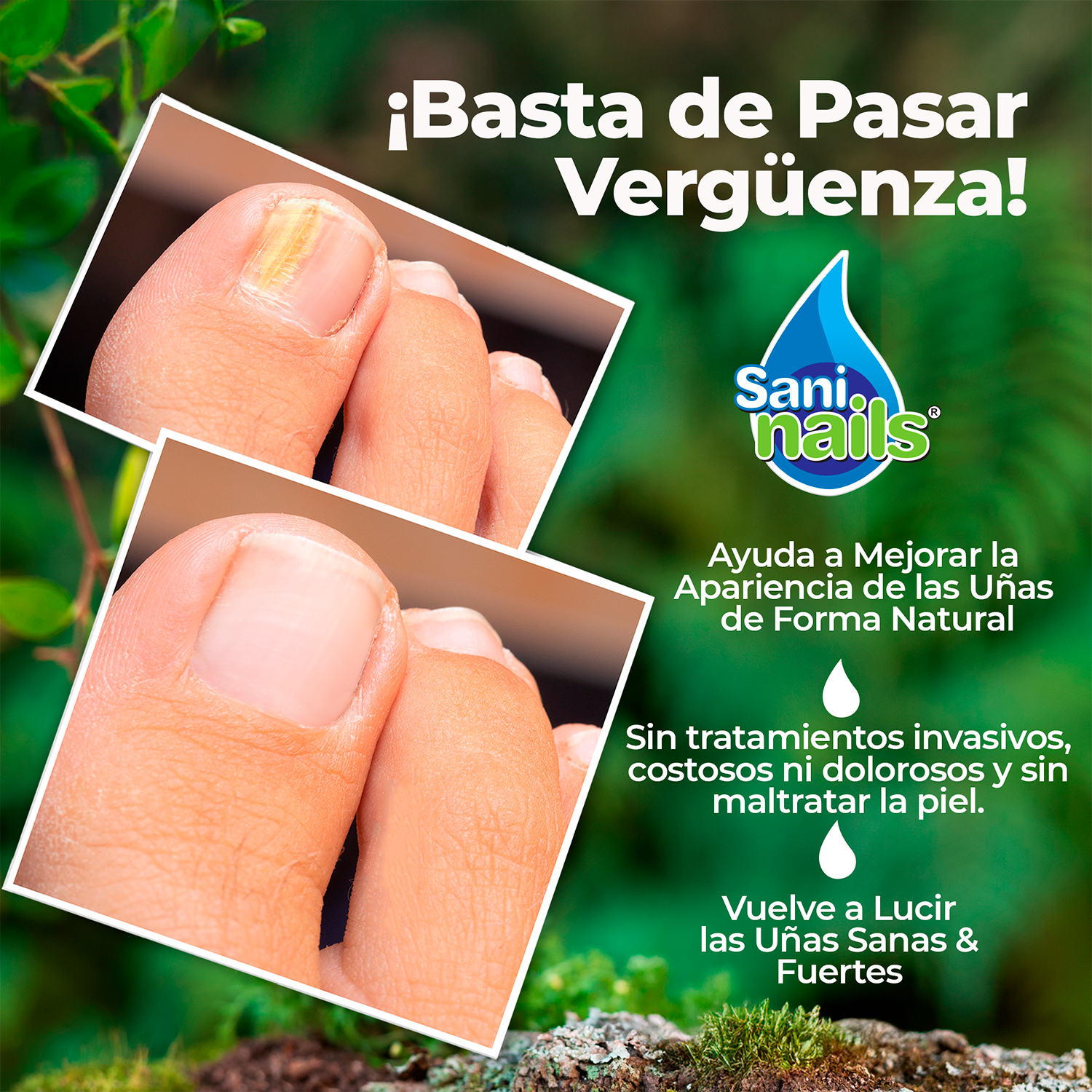 SaniNails Ayuda a Combatir Hongos Uñas - Imagen 3