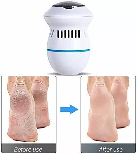 Removedor de Callos Eléctrico Pedicura - Imagen 2